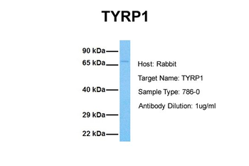 TYRP1 Rabbit Polyclonal Antibody