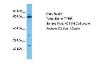 TYRP1 Rabbit Polyclonal Antibody