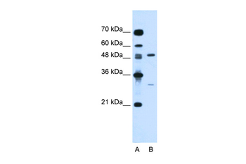 CSF1 Rabbit Polyclonal Antibody