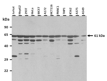 CSF1 Rabbit Polyclonal Antibody