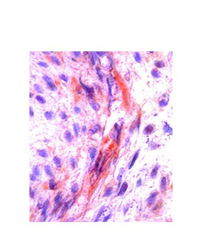 CSF1 Rabbit Polyclonal Antibody