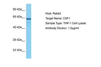 CSF1 Rabbit Polyclonal Antibody