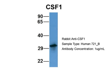 CSF1 Rabbit Polyclonal Antibody