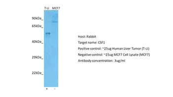 CSF1 Rabbit Polyclonal Antibody