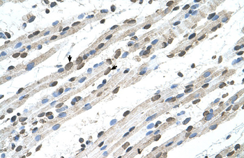 RCE1 Rabbit Polyclonal Antibody