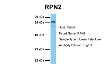 RPN2 Rabbit Polyclonal Antibody