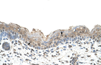 RPN2 Rabbit Polyclonal Antibody