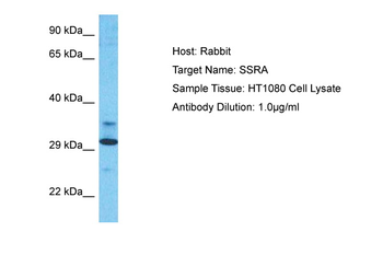 SSR1 Rabbit Polyclonal Antibody
