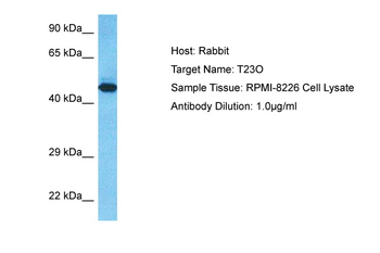 TDO2 Rabbit Polyclonal Antibody
