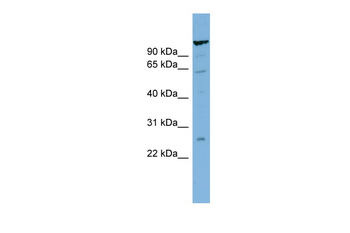 TSBP1 Rabbit Polyclonal Antibody