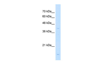 LMAN2 Rabbit Polyclonal Antibody