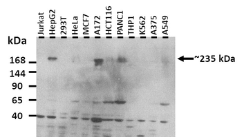 FER1L3 Rabbit Polyclonal Antibody