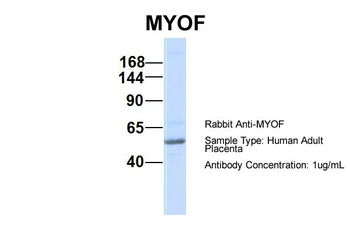 FER1L3 Rabbit Polyclonal Antibody