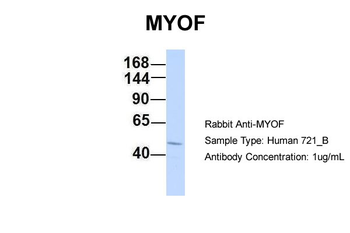 FER1L3 Rabbit Polyclonal Antibody
