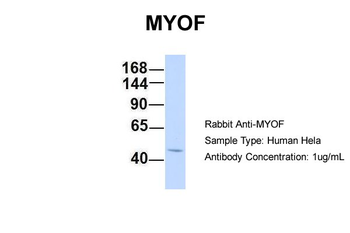 FER1L3 Rabbit Polyclonal Antibody