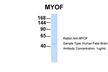 FER1L3 Rabbit Polyclonal Antibody