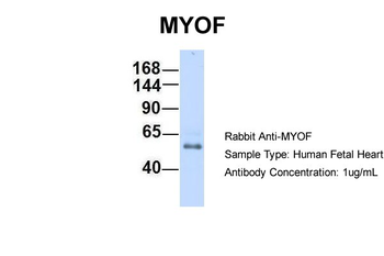 FER1L3 Rabbit Polyclonal Antibody
