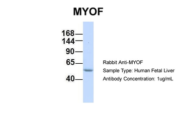 FER1L3 Rabbit Polyclonal Antibody