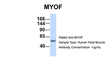 FER1L3 Rabbit Polyclonal Antibody