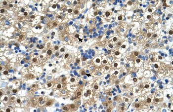 GDE1 Rabbit Polyclonal Antibody