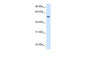 Exd Rabbit Polyclonal Antibody