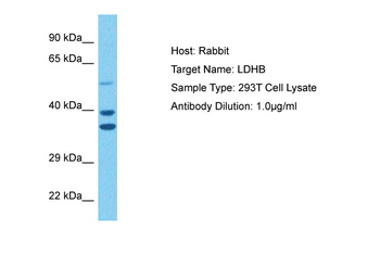 LDHB Rabbit Polyclonal Antibody