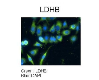 LDHB Rabbit Polyclonal Antibody