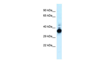LDHB Rabbit Polyclonal Antibody