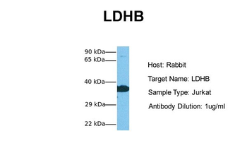 LDHB Rabbit Polyclonal Antibody