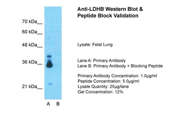 LDHB Rabbit Polyclonal Antibody