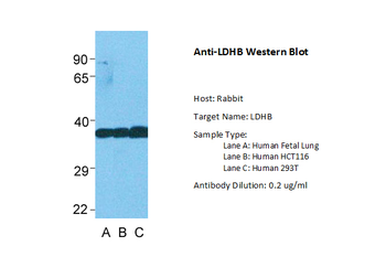 LDHB Rabbit Polyclonal Antibody