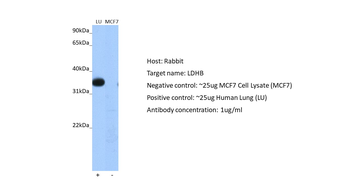 LDHB Rabbit Polyclonal Antibody
