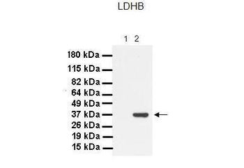 LDHB Rabbit Polyclonal Antibody