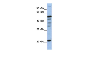 PGDS Rabbit Polyclonal Antibody
