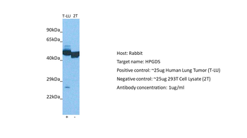 PGDS Rabbit Polyclonal Antibody