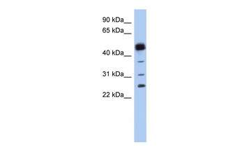 PGDS Rabbit Polyclonal Antibody