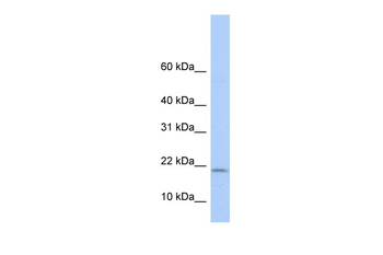 POLR1D Rabbit Polyclonal Antibody