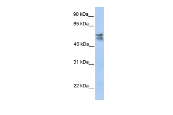 TRMU Rabbit Polyclonal Antibody