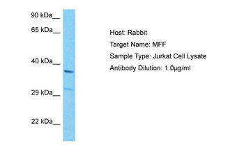 C2orf33 Rabbit Polyclonal Antibody