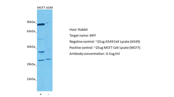 C2orf33 Rabbit Polyclonal Antibody