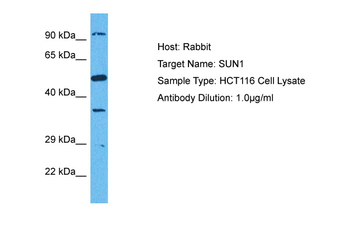 UNC84A Rabbit Polyclonal Antibody