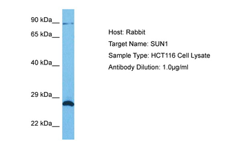 UNC84A Rabbit Polyclonal Antibody