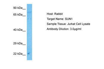 UNC84A Rabbit Polyclonal Antibody