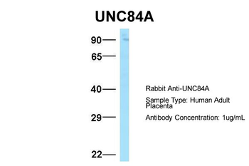 UNC84A Rabbit Polyclonal Antibody