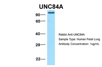 UNC84A Rabbit Polyclonal Antibody