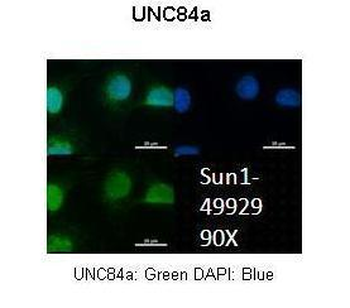 UNC84A Rabbit Polyclonal Antibody