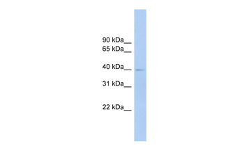 FCRLA Rabbit Polyclonal Antibody