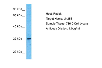 LIN28B Rabbit Polyclonal Antibody