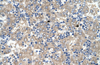 C3orf10 Rabbit Polyclonal Antibody