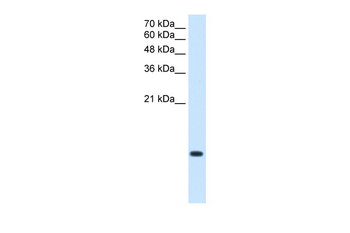 C3orf10 Rabbit Polyclonal Antibody